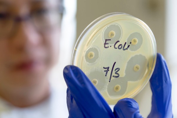 A scientist holds a petri dish with E.Coli.