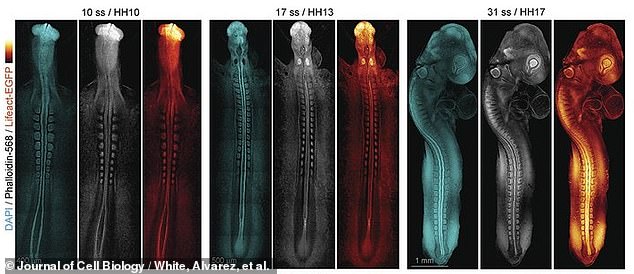 Above, later still images of early spinal cord and embryonic brain formation