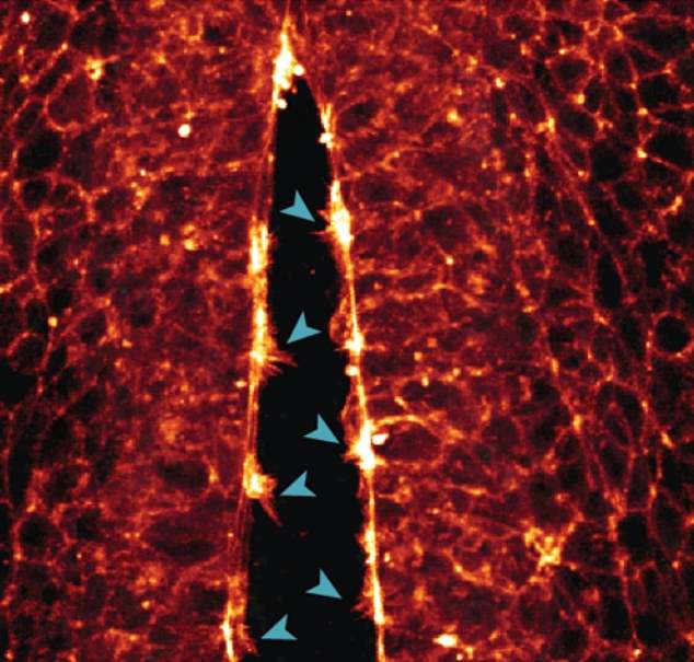 Above, the scientists were able to record the formation of arm-like protrusions on individual cells – which help the cells crawl along the cytoskeleton's protein supports to the correct location.  In the image above, the arms of the cell come together to close the walls of the neural tube.